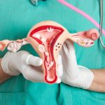 Hysterectomy-uterine-res