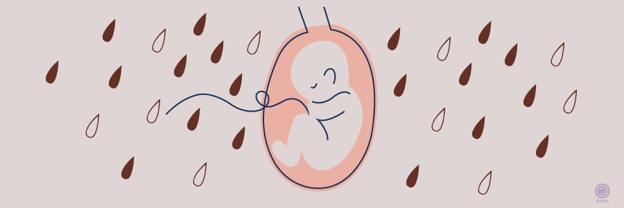 دلایل وجود لکه و یا ترشحات قهوه ای در دوران حاملگی