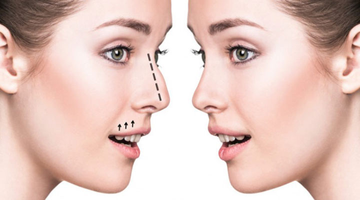 nose-surgery