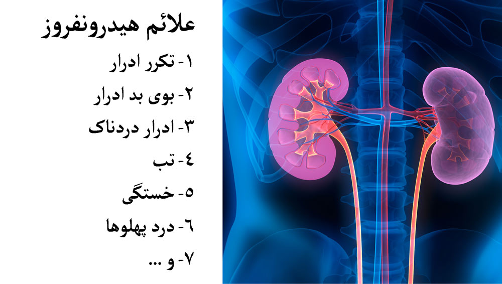 هیدرونفروز چیست؟
