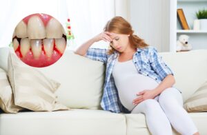 Swollen-gums-during-pregnancy
