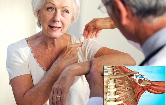 tendinitis -