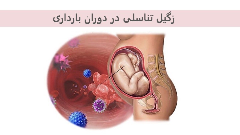 Genital-warts-in-pregnancy