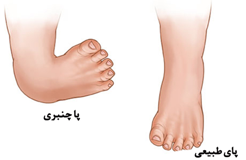 پاچنبر