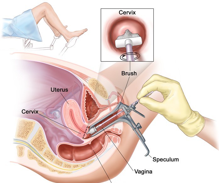 -pap-test
