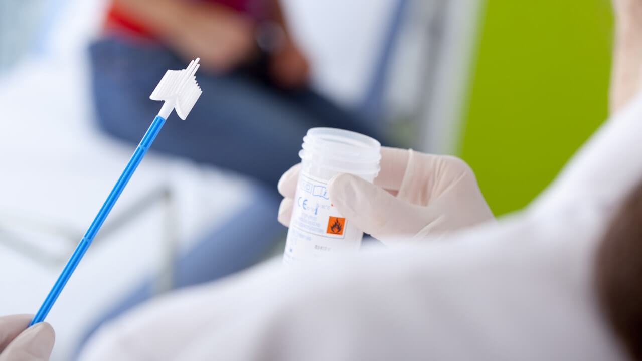 papsmear