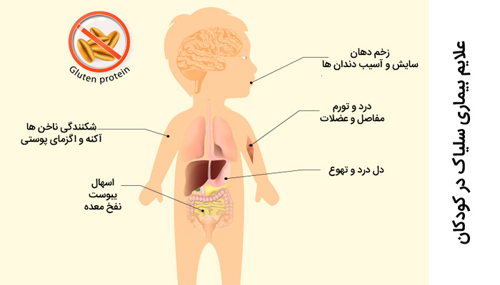 بیماری سلیاک درکودکان