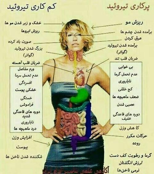 تیروئید