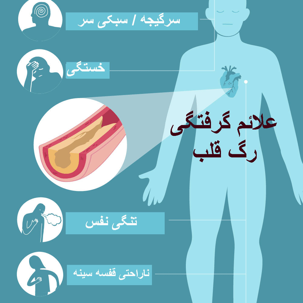 علت گرفتن رگ قلب