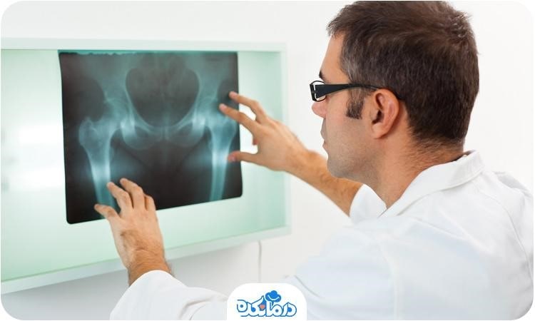 علائم تراکم استخوان