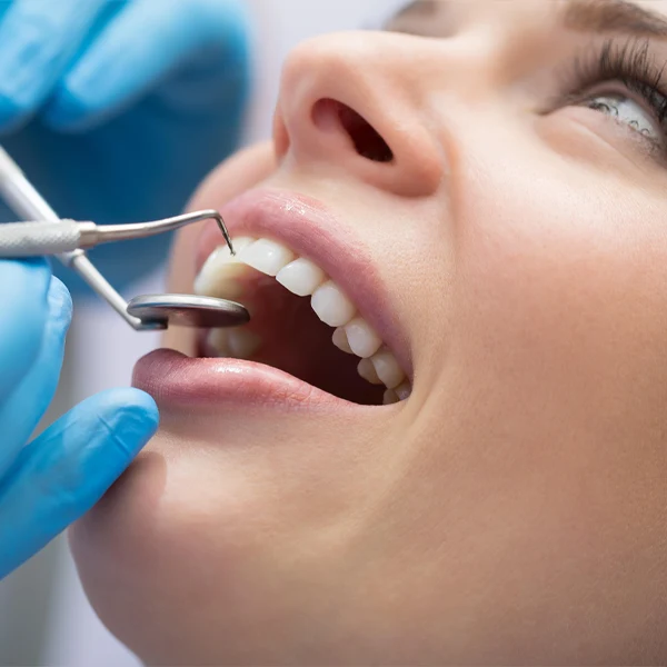 ویژگی های بهترین متخصص لمینت دندان