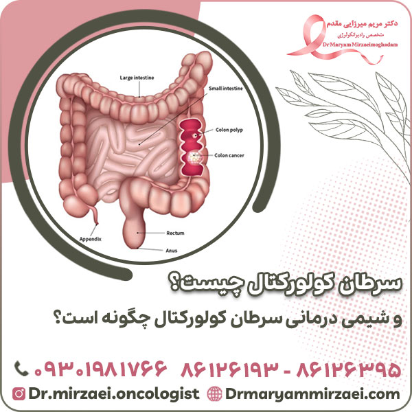 درمان دو نوع سرطان شایع