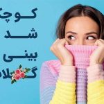 کوچک شدن بینی با گلاب