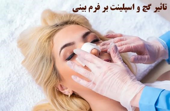 تأثیر استفاده از گچ و اسپلینت بر نتیجه نهایی