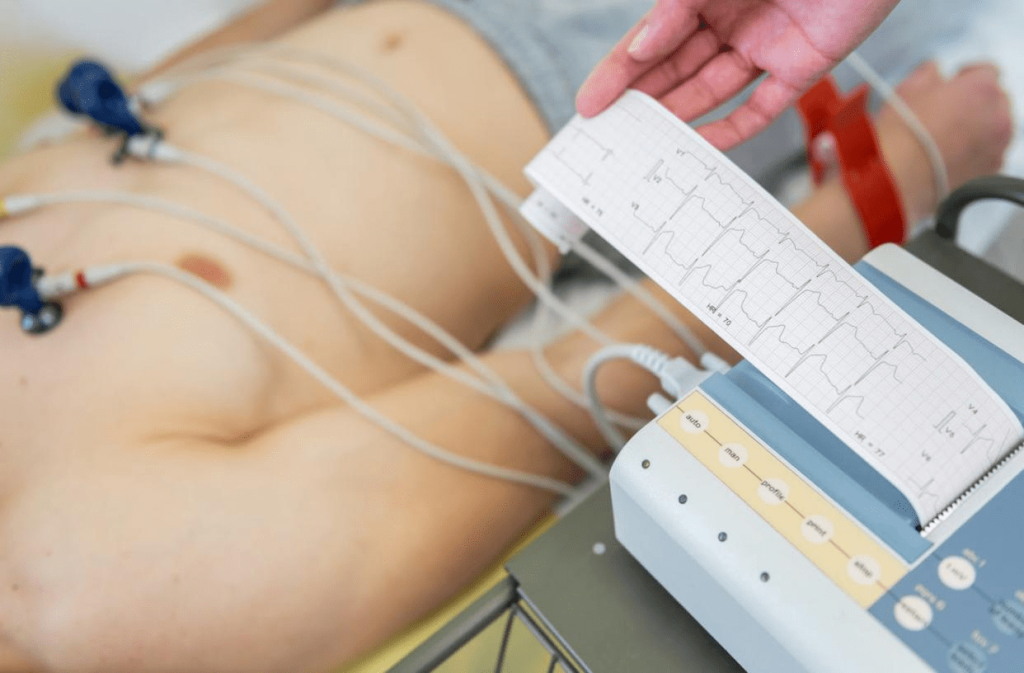 نوار قلب چیست و چه چیزی را اندازهگیری میکند؟
