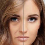 کاندیدای مناسب برای انجام تزریق چربی