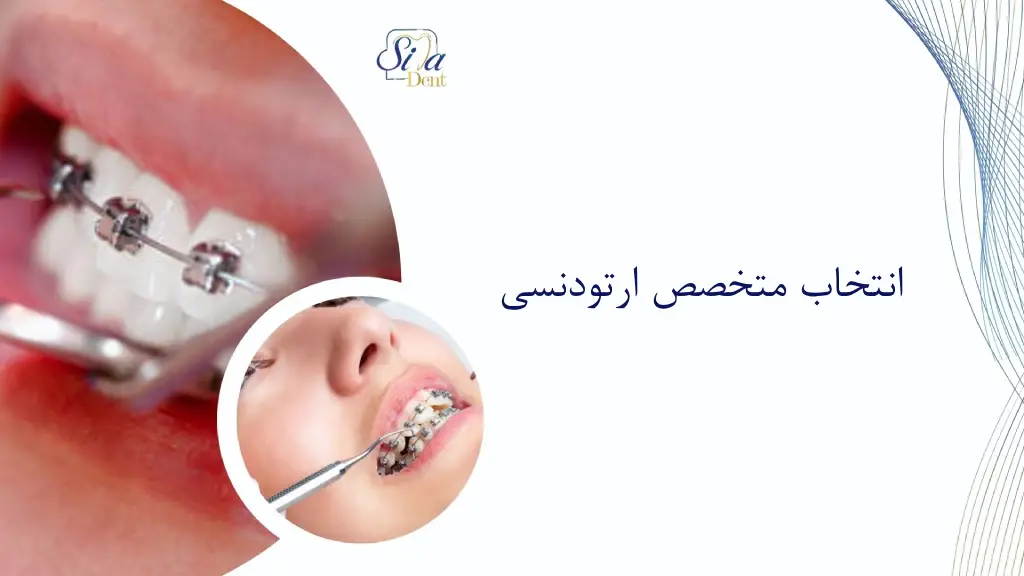 انتخاب متخصص ارتودنسی