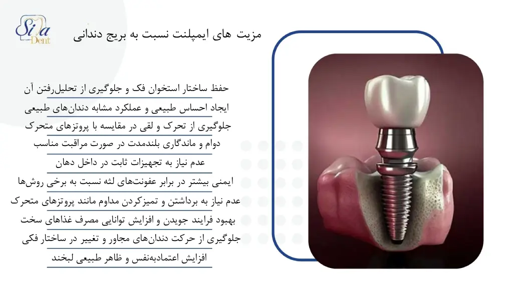 مزایای ایمپلنت دندان
