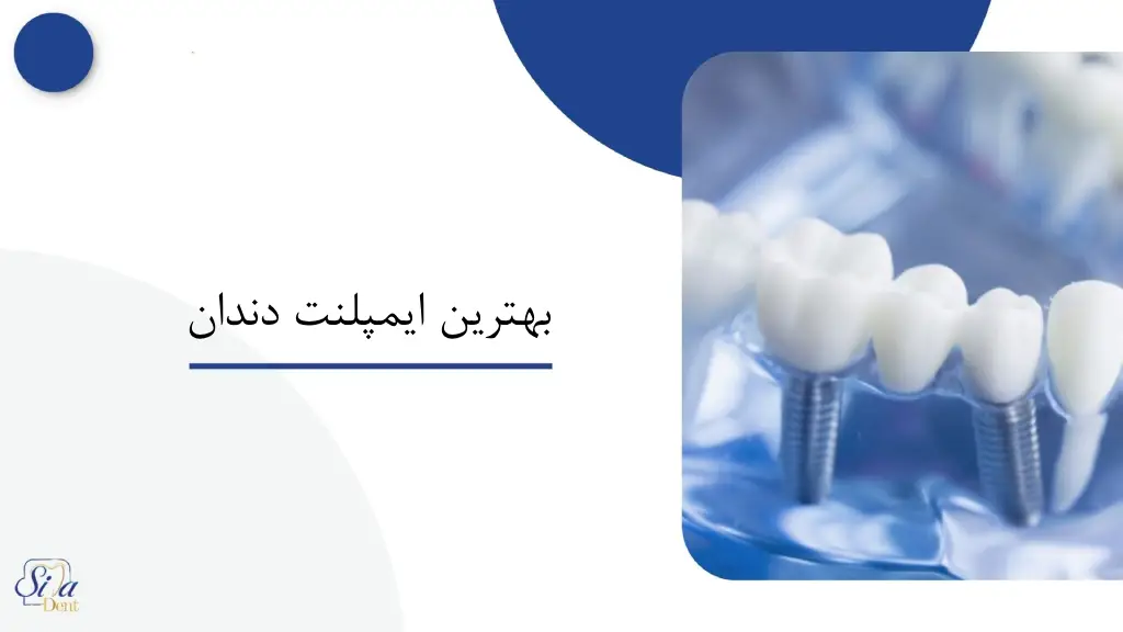 هزینه ایمپلنت دندان