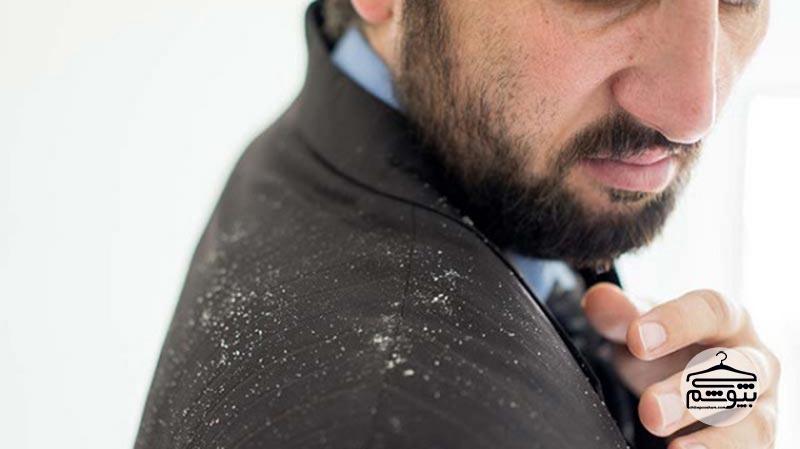 Dandruff: Causes, Types, Treatment, and Complete Prevention Guide