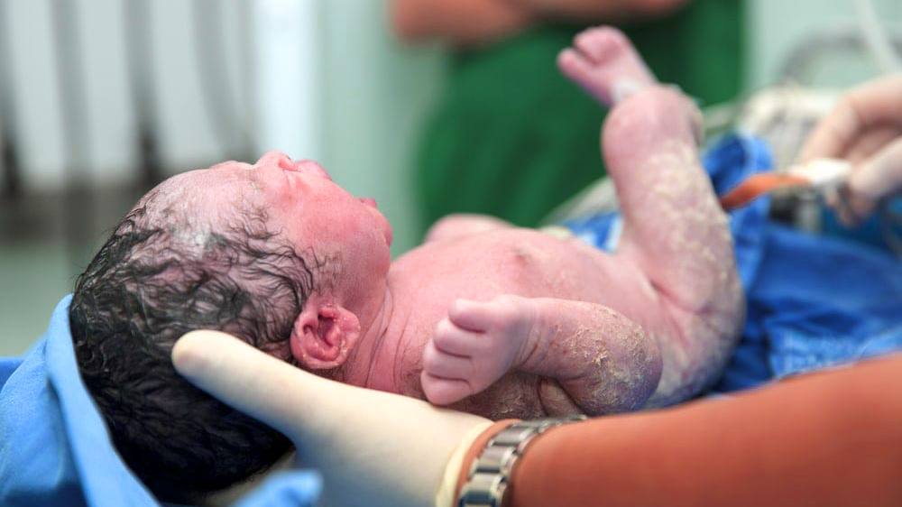 راهنمای جامع زایمان: مراحل، انواع، آمادگی و مدیریت درد