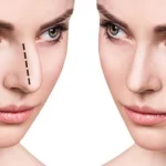 راهنمای جامع عمل بینی