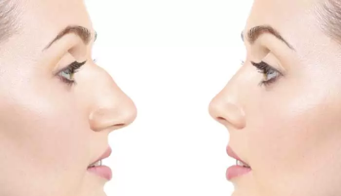 راهنمای جامع عمل بینی