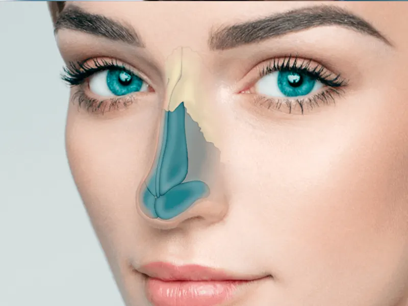 راهنمای جامع عمل بینی