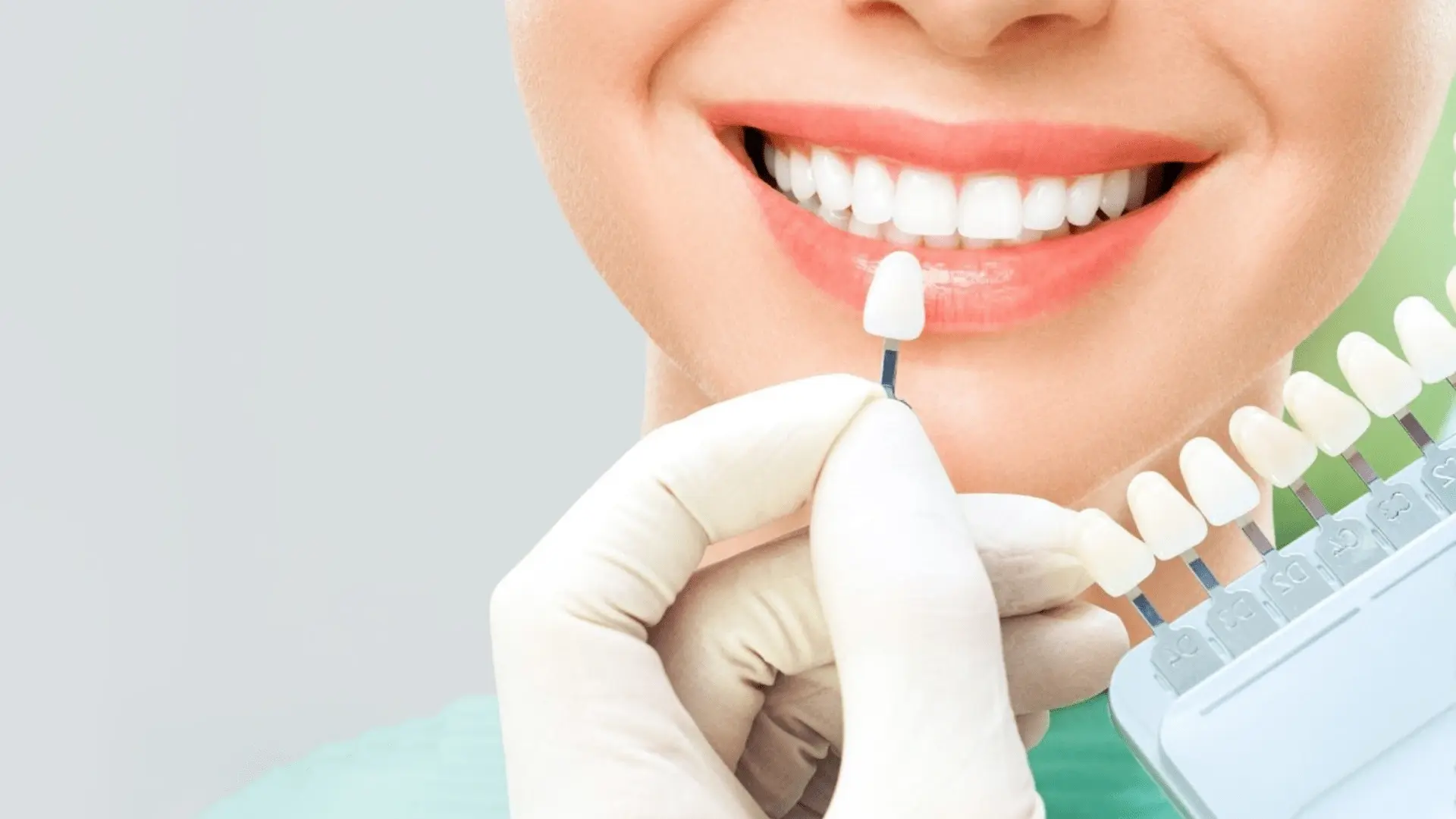 کامپوزیت دندان: کاربرد، انواع، مزایا و مراقبت برای لبخندی درخشان