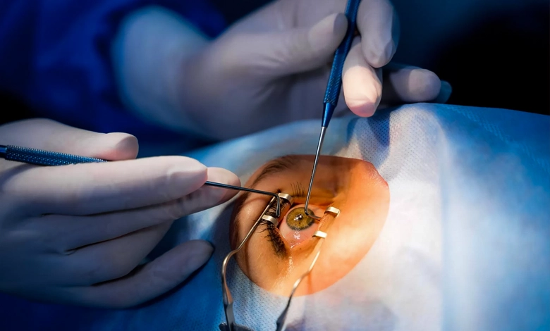 عمل آب مروارید بیمارستان پارسا