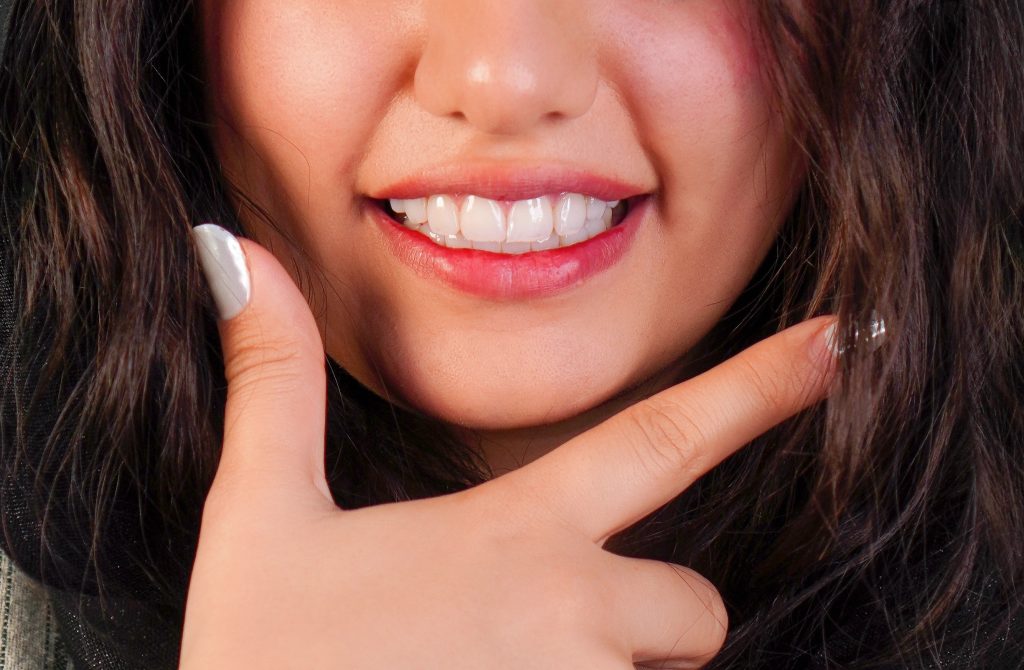 لمینت دندان