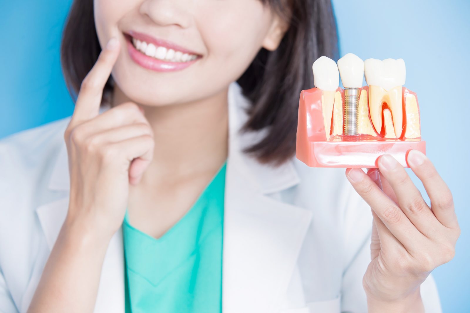 ایمپلنت دندان: راهنمای کامل کاشت، انواع، مزایا و هزینه