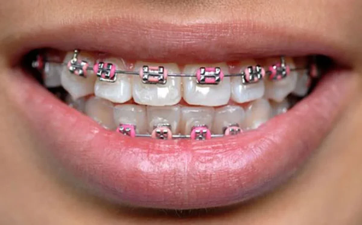 ارتودنسی دندان