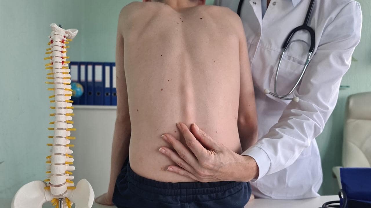 بهترین دکتر برای درمان اسکولیوز