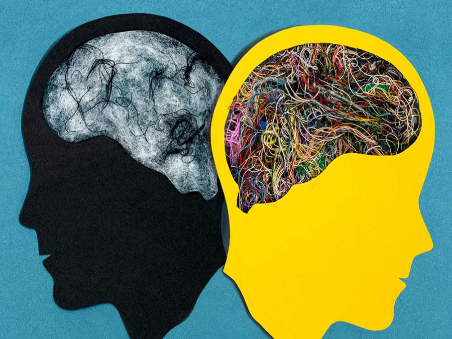 اختلال دوقطبی