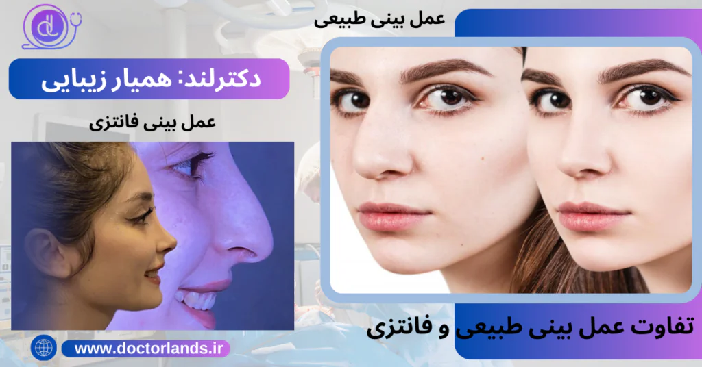 وام عمل بینی در شیراز | دکترلند 