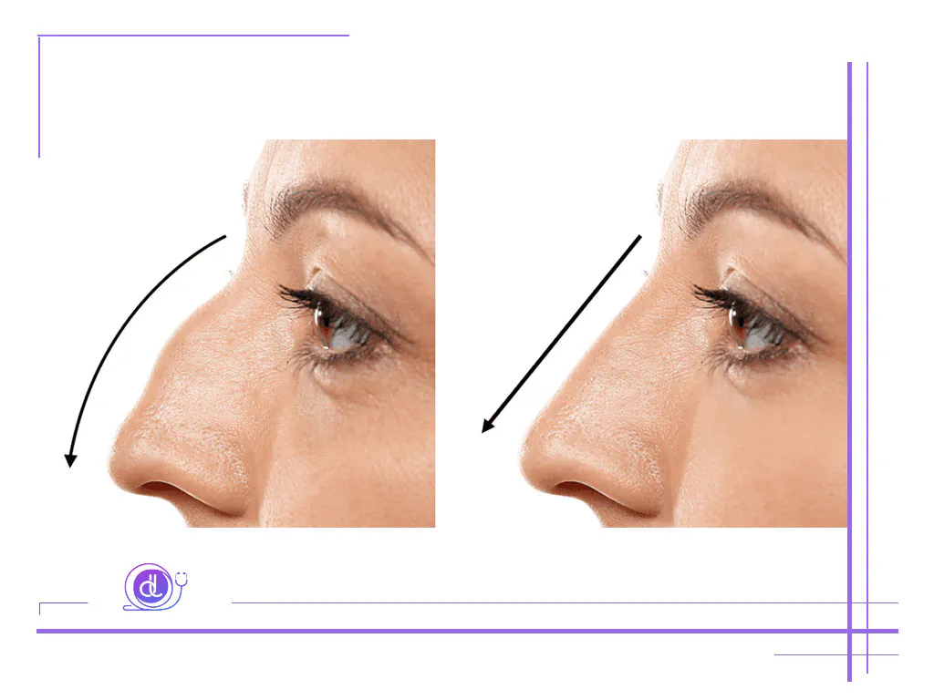 وام عمل بینی در شیراز | دکترلند 