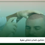چگونه موهای کاشته شده سریع‌تر رشد کنند؟