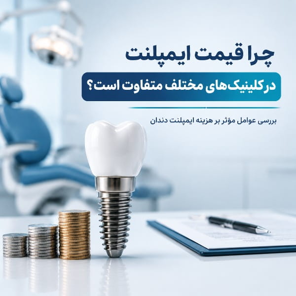 چرا قیمت ایمپلنت در کلینیک‌های مختلف متفاوت است؟