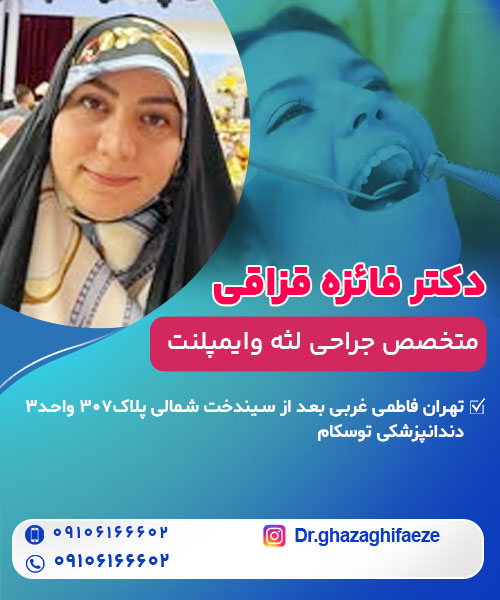دکتر فائزه قزاقی متخصص جراحی لثه وایمپلنت در تهران