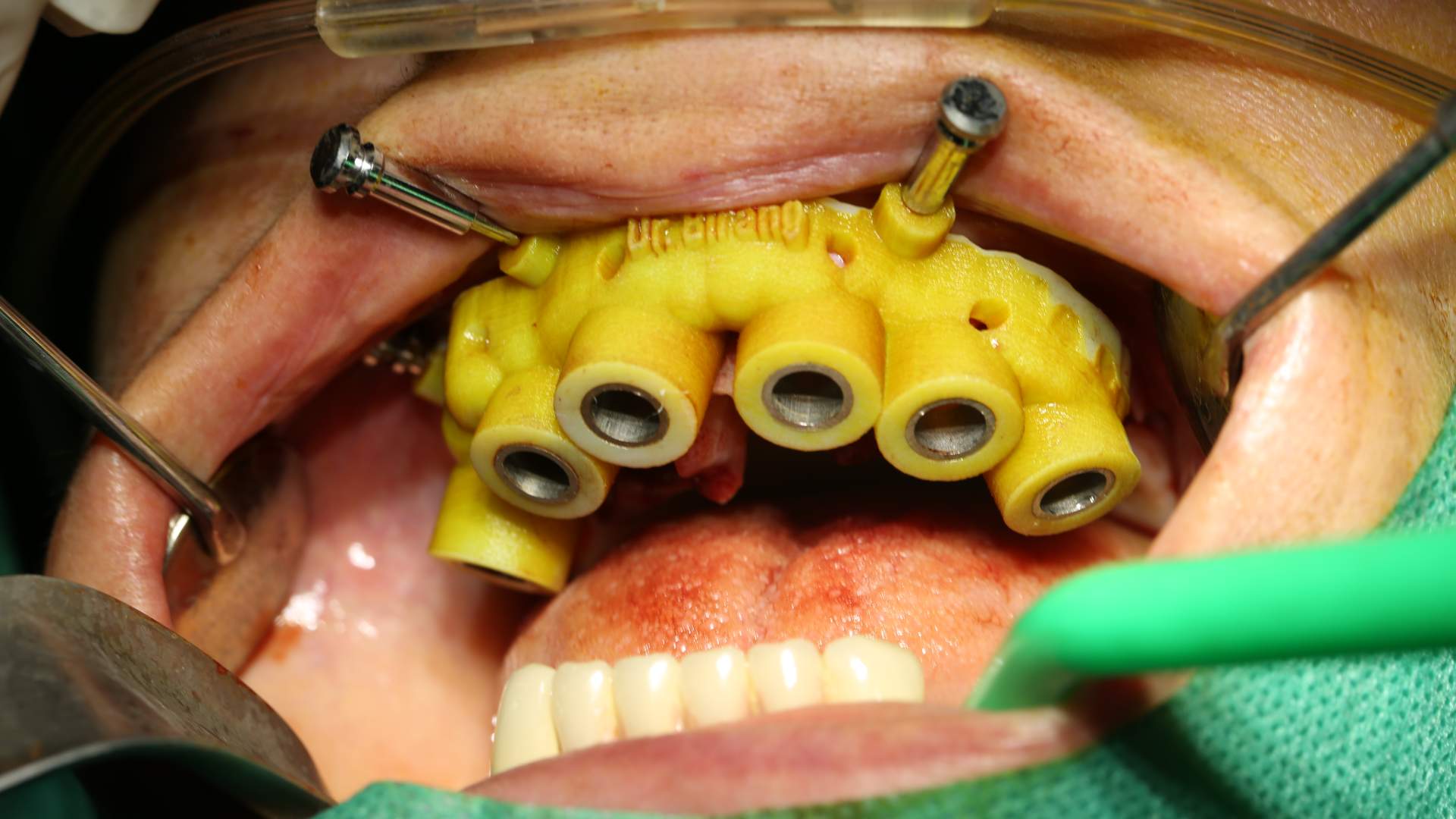 دکتر احسان بیرنگ - gallery