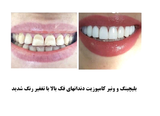 زهرا زنديه - gallery