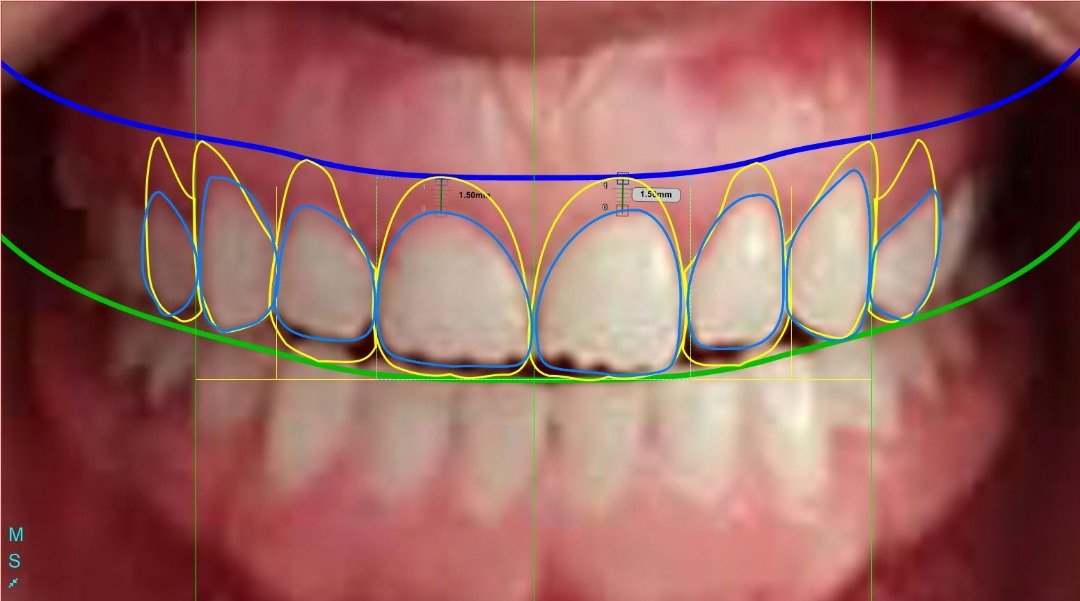 دکتر احسان بیرنگ - gallery