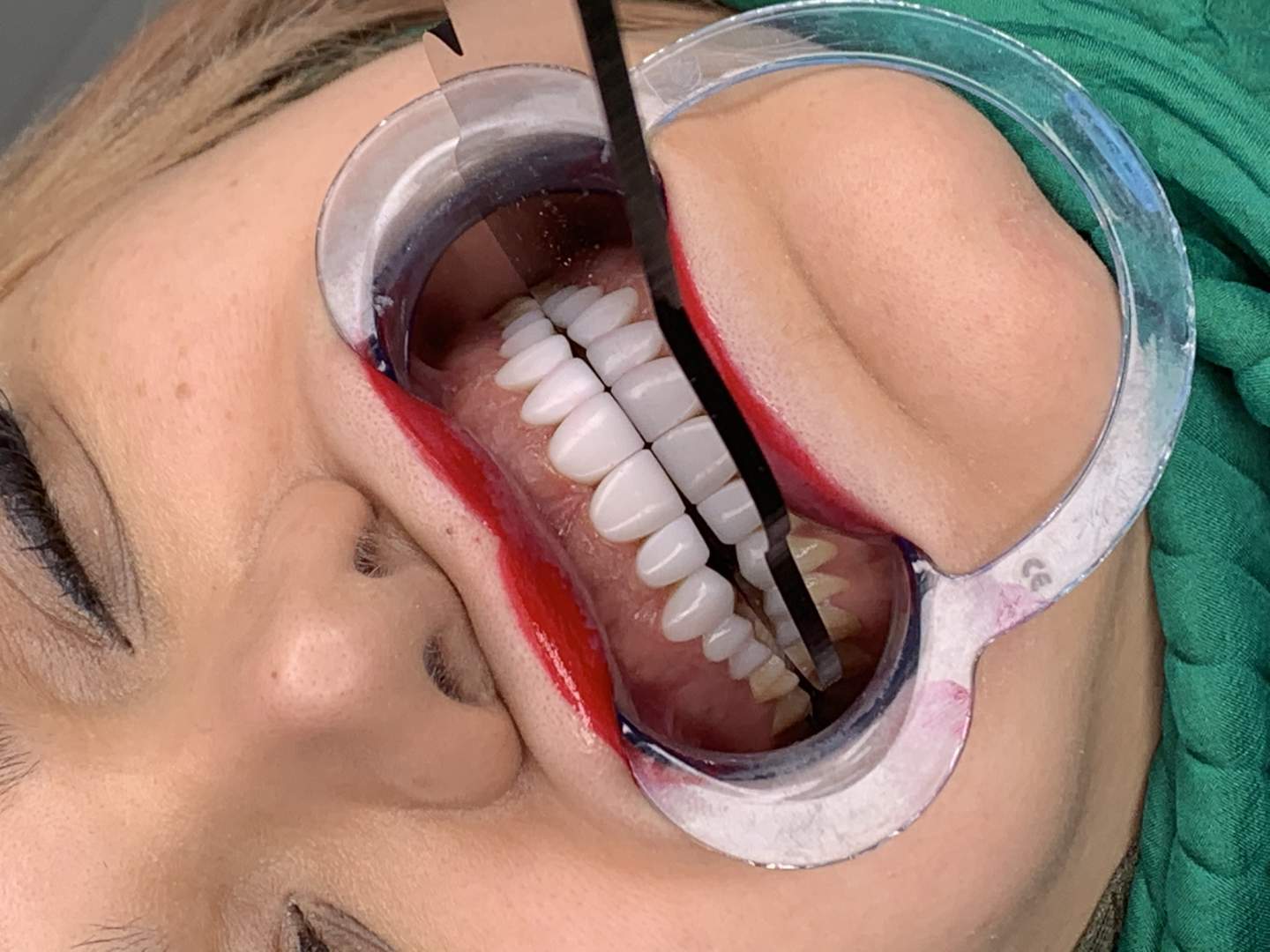 دندانپزشکی ایرانمهر - gallery