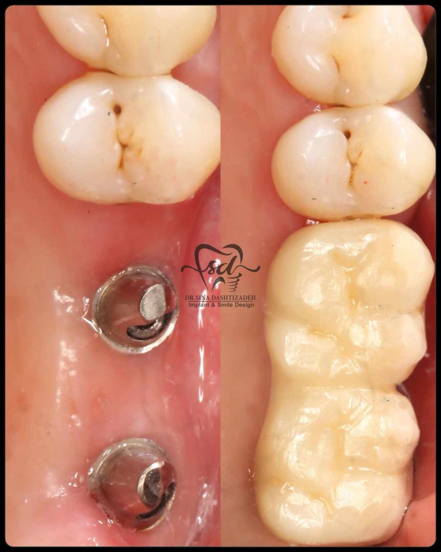 دکتر سینا دشتی زاده - gallery