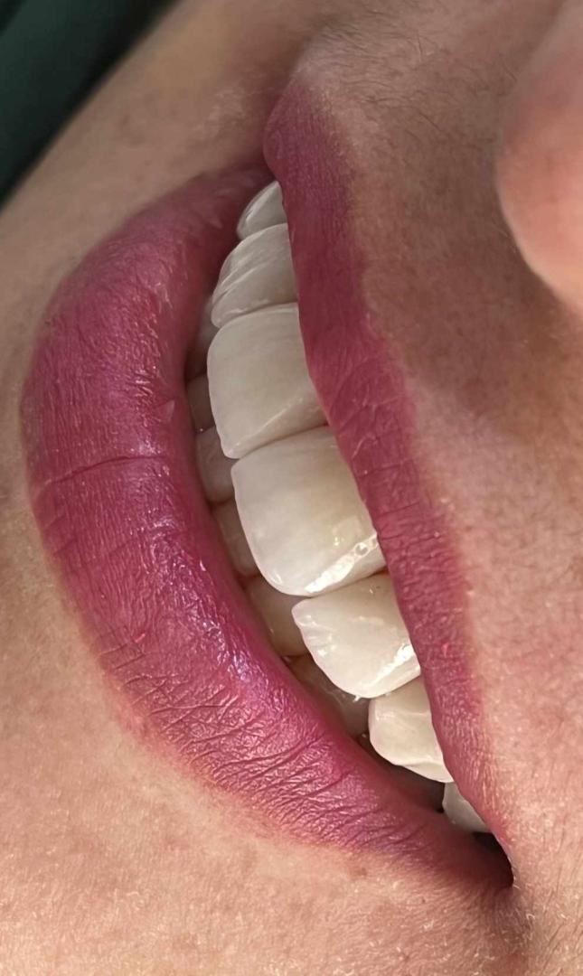 دکتر آزاده سلیمانیان - gallery