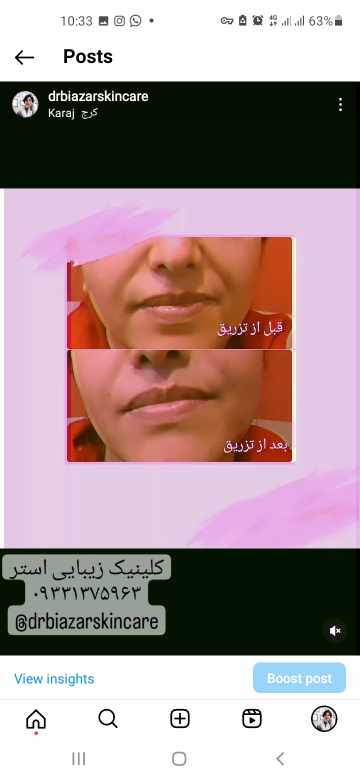 تهمینه بی آزار - gallery