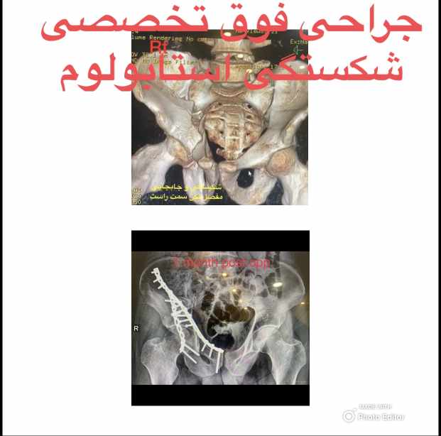 دکتر علیرضا صحرانورد - gallery