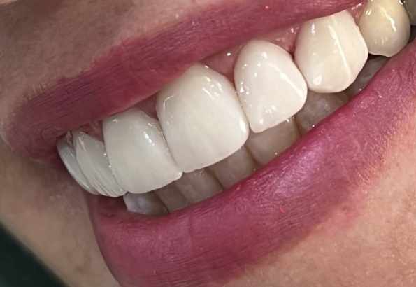 دکتر آزاده سلیمانیان - gallery