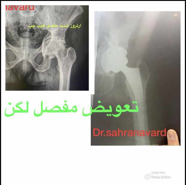 دکتر علیرضا صحرانورد - gallery